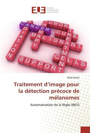 Couverture du livre « Traitement d image pour la detection precoce de melanomes » de Kasmi-R aux éditions Editions Universitaires Europeennes