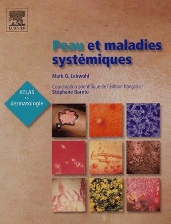 Couverture du livre « Peau et maladies systémiques » de Mark G. Lebwohl et Stephane Barete aux éditions Elsevier-masson