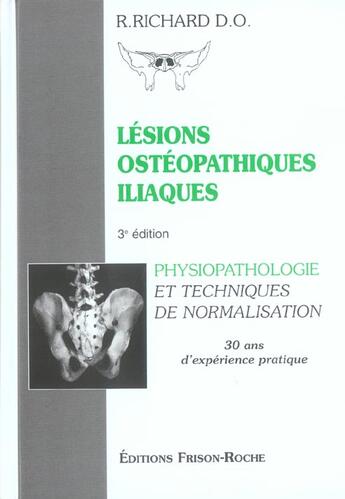 Couverture du livre « Lesions osteopathiques iliaques ; physiopathologie et techniques de normalisation ; 30 ans d'experience pratique (3e édition) » de Raymond Richard aux éditions Frison Roche