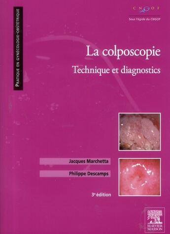 Couverture du livre « La colposcopie ; technique et diagnostics (3e édition) » de Philippe Descamps et Jacques Marchetta aux éditions Elsevier-masson