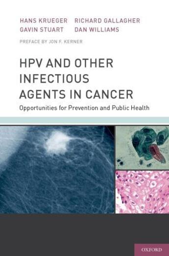 Couverture du livre « HPV and Other Infectious Agents in Cancer: Opportunities for Preventio » de Kerner Jon aux éditions Oxford University Press Usa