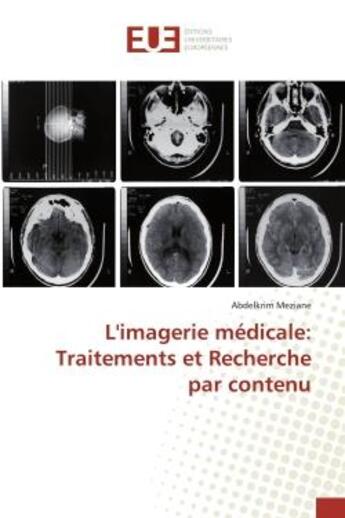 Couverture du livre « L'imagerie medicale: traitements et recherche par contenu » de Meziane Abdelkrim aux éditions Editions Universitaires Europeennes