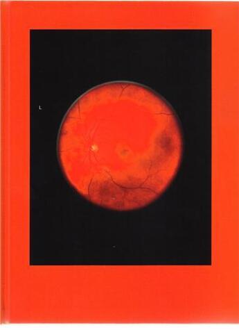 Couverture du livre « Mikhael subotzky retinal shift » de Mikhael Subotzky aux éditions Steidl