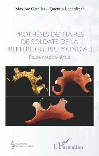 Couverture du livre « Prothèses dentaires de soldats de la Première Guerre mondiale : étude médico-légale » de Maxime Gatelier et Quentin Lecardinal aux éditions L'harmattan