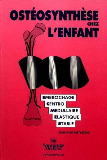 Couverture du livre « Osteosynthese de l enfant par embrochage centro medullaire elastique stable » de Metaizeau Jean-Paul aux éditions Sauramps Medical