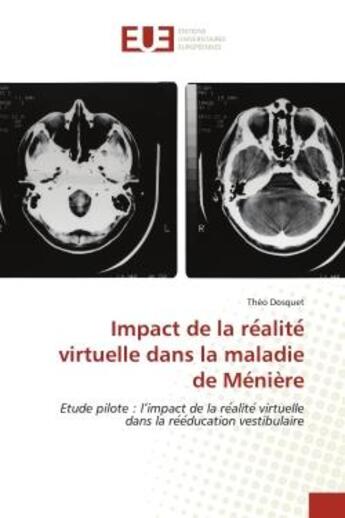 Couverture du livre « Impact de la re alite virtuelle dans la maladie de meniere - etude pilote : l'impact de la re alite » de Dosquet Theo aux éditions Editions Universitaires Europeennes