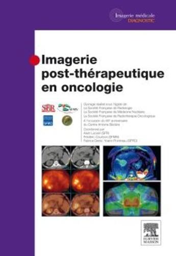 Couverture du livre « Imagerie post-thérapeutique en oncologie » de  aux éditions Elsevier-masson