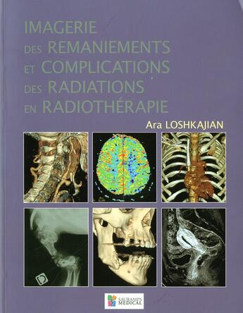 Couverture du livre « Imagerie des ramaniements et complications des radiations en radiothérapie » de Ara Loshkakjian aux éditions Sauramps Medical