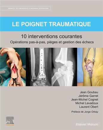 Couverture du livre « Le poignet traumatique, 10 interventions courantes : manuel de chirurgie du membre supérieur » de  aux éditions Elsevier-masson