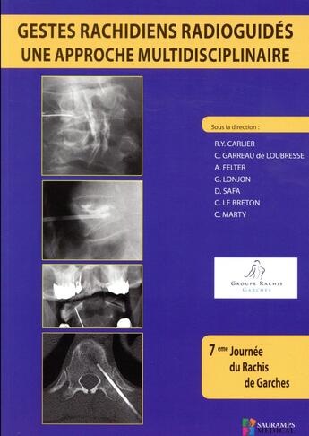 Couverture du livre « Gestes rachidiens radioguides ; une approche » de Carlier Ry aux éditions Sauramps Medical