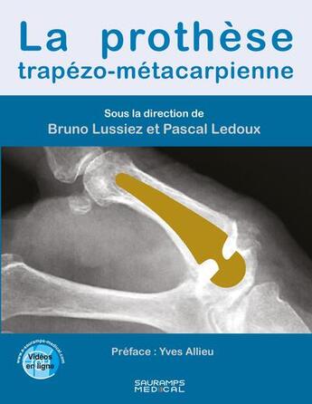 Couverture du livre « La prothèse trapézo-métacarpienne » de Bruno Lussiez et Collectif et Pascal Ledoux aux éditions Sauramps Medical