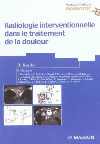 Couverture du livre « Radiologie interventionnelle dans le traitement de la douleur » de  aux éditions Elsevier-masson