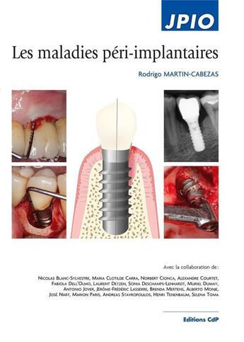 Couverture du livre « Les maladies péri-implantaires » de Rodrigo Martin-Cabezas aux éditions Cahiers De Protheses