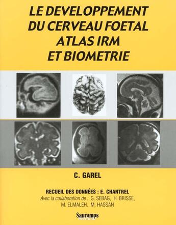 Couverture du livre « Le développement du cerveau foetal, atlas IRM et biometrie » de Catherine Garel aux éditions Sauramps Medical