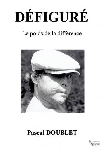 Couverture du livre « Défiguré ; le poids de la différence » de Pascal Doublet aux éditions Pascal Doublet