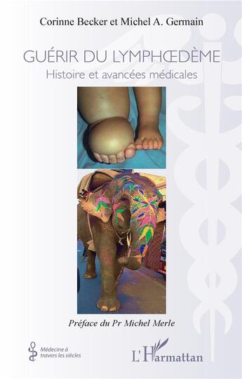 Couverture du livre « Guérir du lymphoedème : histoires et avancées médicales » de Becker/Germain aux éditions L'harmattan