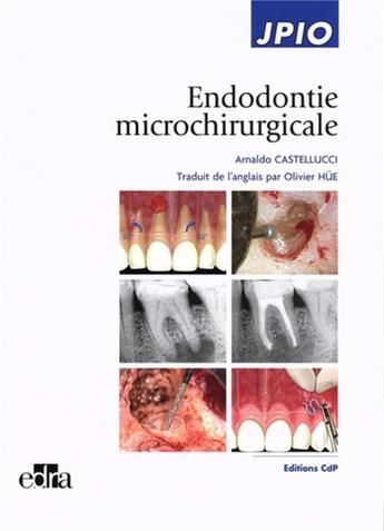Couverture du livre « Endodontie microchirurgicale » de Arnaldo Castellucci aux éditions Cahiers De Protheses