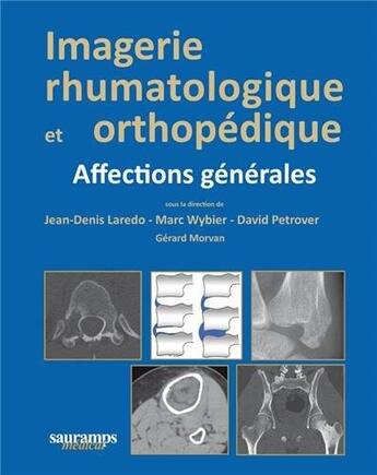 Couverture du livre « Imagerie rhumatologique et orthopédique t.1 : affections générales » de Jean-Denis Laredo et Gerard Morvan et Marc Wybier et Marc Petrover aux éditions Sauramps Medical