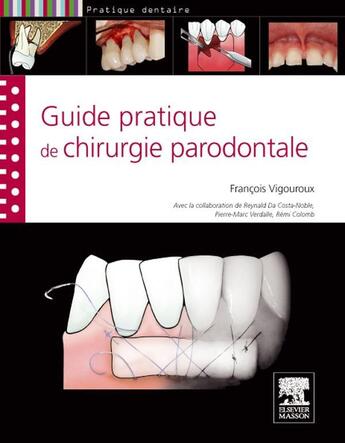 Couverture du livre « Guide pratique de la chirurgie parodontale » de Francois Vigouroux et N Da Costa aux éditions Elsevier-masson