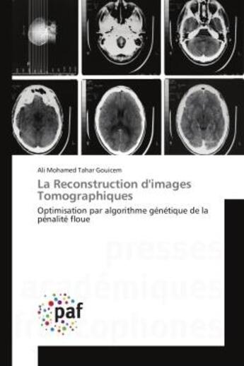 Couverture du livre « La reconstruction d'images tomographiques - optimisation par algorithme genetique de la penalite flo » de Gouicem A M T. aux éditions Presses Academiques Francophones