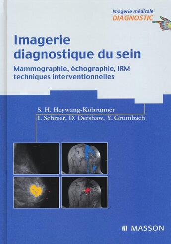 Couverture du livre « Imagerie Diagnostique Du Sein. Mammographie, Echographie, Irm, Techniques Interventionnelles » de Heywang-Kobrunner/Sc aux éditions Elsevier-masson