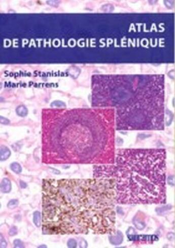 Couverture du livre « Atlas de pathologie splénique » de Stanislas S aux éditions Sauramps Medical