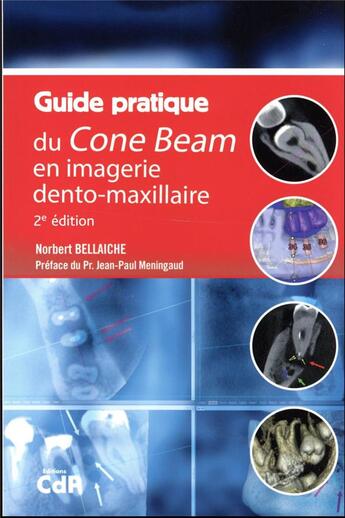 Couverture du livre « Guide pratique du Cone Beam en imagerie dento-maxillaire (2e édition) » de Norbert Bellaiche aux éditions Cahiers De Protheses