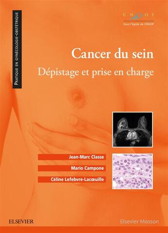 Couverture du livre « Cancer du sein ; dépistage et prise en charge » de Jean-Marc Classe aux éditions Elsevier-masson