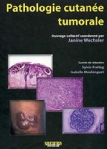 Couverture du livre « Pathologie cutanée tumorale » de Janine Wechsler aux éditions Sauramps Medical