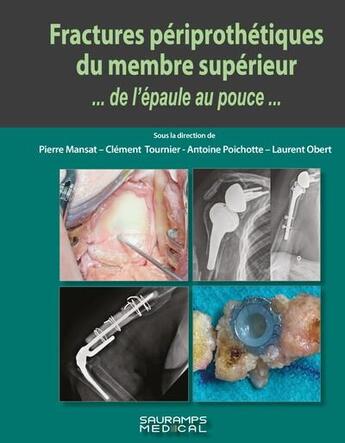 Couverture du livre « Fractures périprothétiques du membre supérieur... de l'épaule au pouce... » de Laurent Obertone et Pierre Mansat et Clement Tournier et Collectif et Antoine Poichotte aux éditions Sauramps Medical