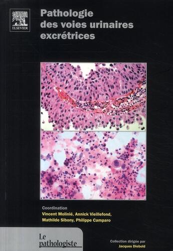 Couverture du livre « Pathologie des voies urinaires excrétrices » de Vieillefond-A+Campar aux éditions Elsevier-masson