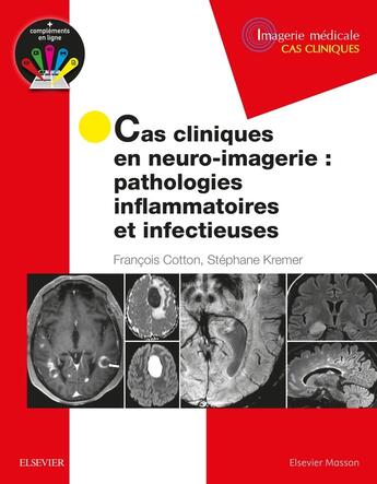 Couverture du livre « Cas cliniques en neuro-imagerie : pathologies inflammatoires et infectieuses » de Francois Cotton et Stephane Kremer aux éditions Elsevier-masson