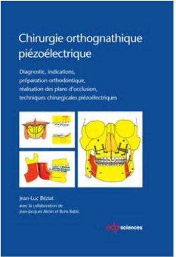 Couverture du livre « Chirurgie orthognathique piézoélectrique » de Jean-Luc Beziat aux éditions Parresia