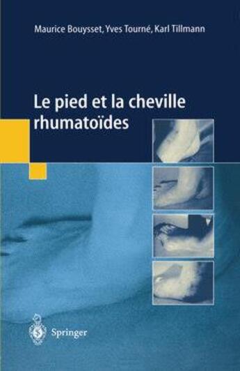 Couverture du livre « Le pied et la cheville rhumatoides » de Maurice Bouysset aux éditions Springer