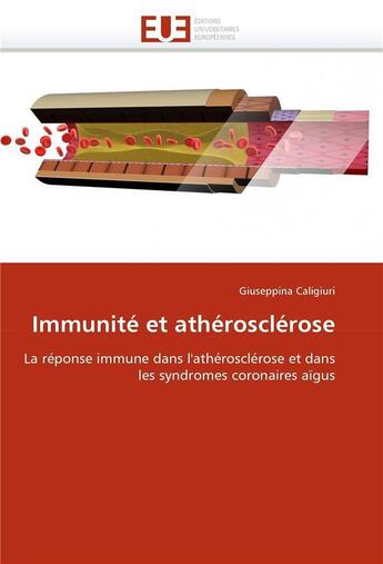 Couverture du livre « Immunite et atherosclerose » de Caligiuri-G aux éditions Editions Universitaires Europeennes