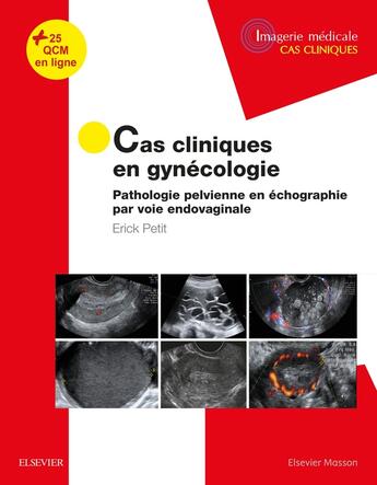 Couverture du livre « Cas cliniques en gynécologie » de Erick Petit aux éditions Elsevier-masson