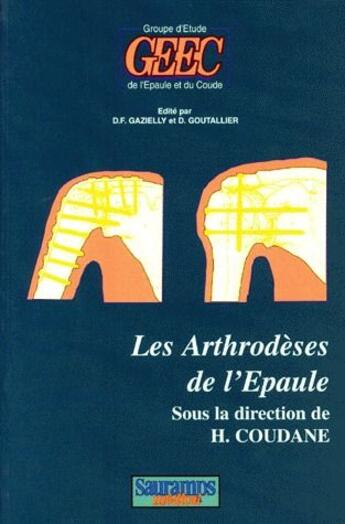 Couverture du livre « Les arthrodeses de l'epaule » de Coudane H aux éditions Sauramps Medical