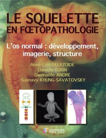 Couverture du livre « Le squelette en foetopathologie ; introduction à la pathologie squelettique foetale » de Anne-Lise Delezoide et Danielle Eurin et Gwenaelle Andre et Suonavy Khung-Savatovsky aux éditions Sauramps Medical