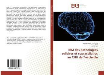 Couverture du livre « Irm des pathologies sellaires et suprasellaires au chu de treichville » de Valerie Acko-Ohui E. aux éditions Editions Universitaires Europeennes