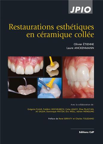 Couverture du livre « Restaurations esthétiques en céramique collée (2e édition) » de Laure Anckenmann et Olivier Etienne et Gregoire Flaus et Frederic Heichelbech et Colas Lemoy et Elise Pilavyan aux éditions Cahiers De Protheses