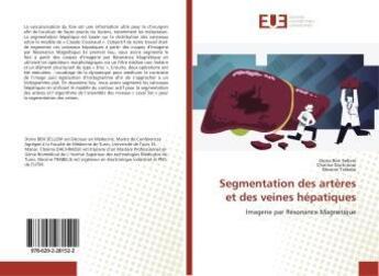 Couverture du livre « Segmentation des artères et des veines hépatiques » de Dorra Ben Sellem aux éditions Editions Universitaires Europeennes