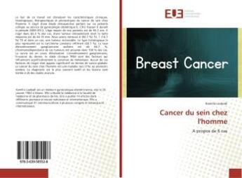 Couverture du livre « Cancer du sein chez l'homme - a propos de 6 cas » de Laabadi Kamilia aux éditions Editions Universitaires Europeennes