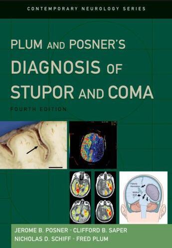 Couverture du livre « Plum and posner's diagnosis of stupor and coma » de Plum Fred aux éditions Editions Racine