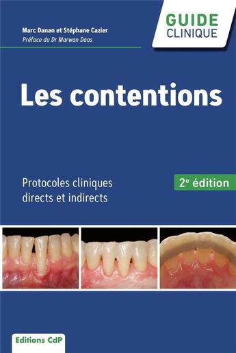 Couverture du livre « Les contentions : protocoles cliniques directs et indirects (2e édition) » de Marc Danan et Stephane Cazier aux éditions Cahiers De Protheses