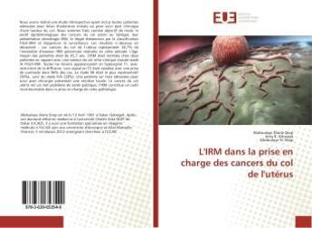 Couverture du livre « L'irm dans la prise en charge des cancers du col de l'uterus » de Dione Diop Abdoulaye aux éditions Editions Universitaires Europeennes