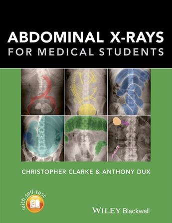 Couverture du livre « Abdominal X-rays for Medical Students » de Christopher Clarke et Anthony Dux aux éditions Wiley-blackwell