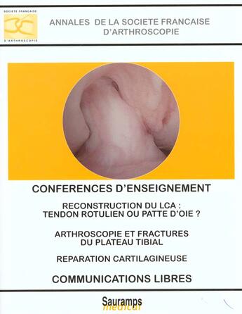 Couverture du livre « Annales de la societe francaise d'arthroscopie 1999 ; conferences d'enseignement ; communications » de  aux éditions Sauramps Medical