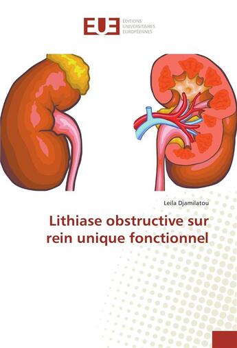 Couverture du livre « Lithiase obstructive sur rein unique fonctionnel » de Leila Djamilatou aux éditions Editions Universitaires Europeennes