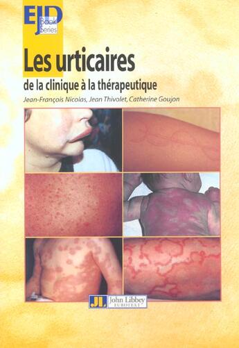 Couverture du livre « Les urticaires-de la clinique a la therapeutique » de Nicolas aux éditions John Libbey