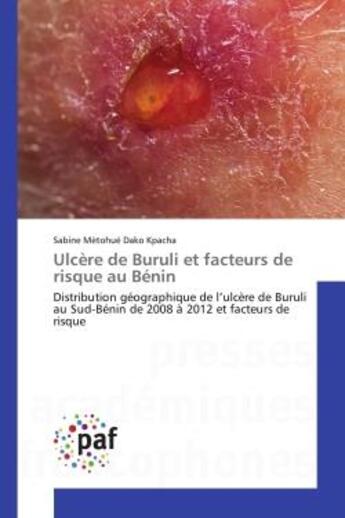 Couverture du livre « Ulcere de buruli et facteurs de risque au benin - distribution geographique de l'ulcere de buruli au » de Dako Kpacha S M. aux éditions Presses Academiques Francophones